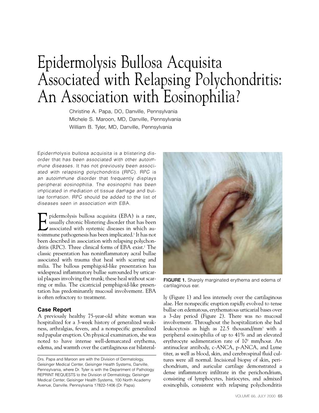 Epidermolysis Bullosa Acquisita Associated with Relapsing Polychondritis: an Association with Eosinophilia? Christine A