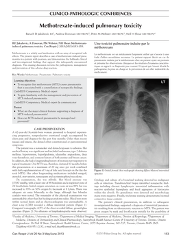 Methotrexate-Induced Pulmonary Toxicity