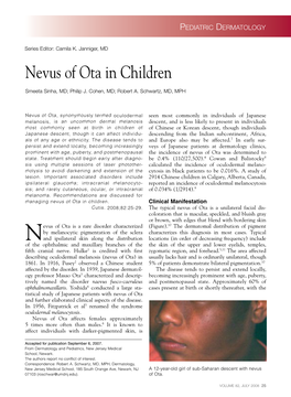 Nevus of Ota in Children