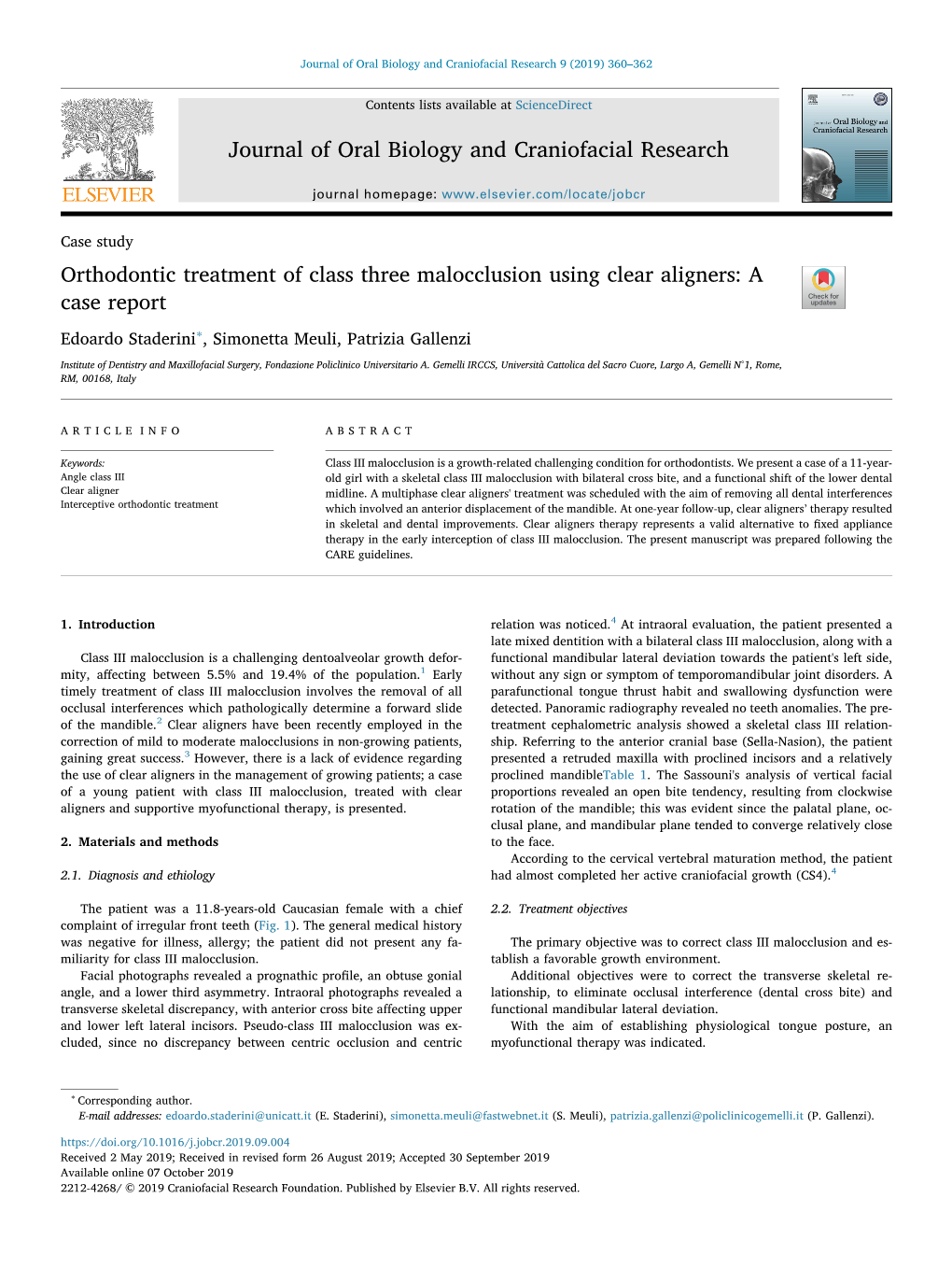 Orthodontic Treatment of Class Three Malocclusion Using Clear Aligners