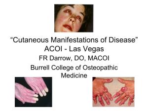 Dermatological Indications of Disease - Part II This Patient on Dialysis Is Showing: A