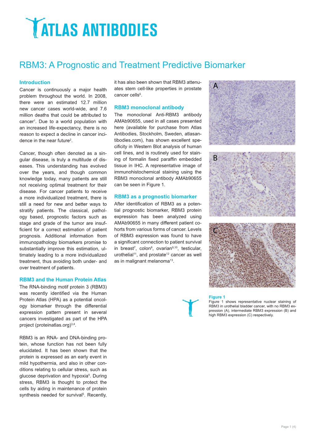 RBM3: a Prognostic and Treatment Predictive Biomarker