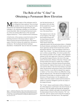 The Role of the “C-Line” in Obtaining a Permanent Brow Elevation