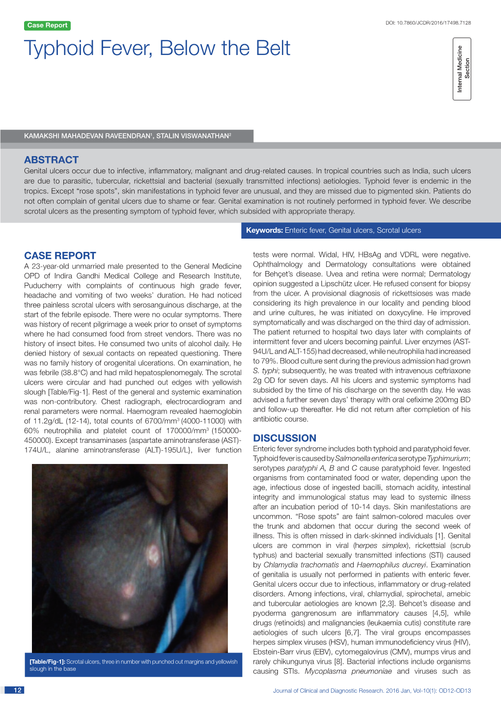 Typhoid Fever, Below the Belt Section Internal Medicine