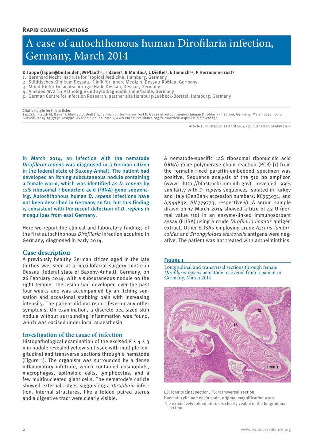 A Case of Autochthonous Human Dirofilaria Infection, Germany, March 2014