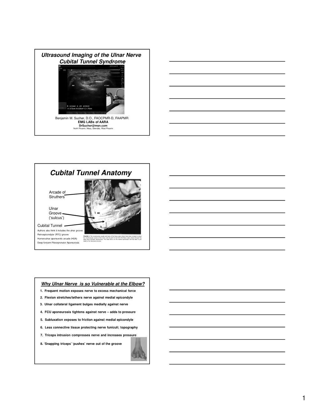 Cubital Tunnel Anatomy