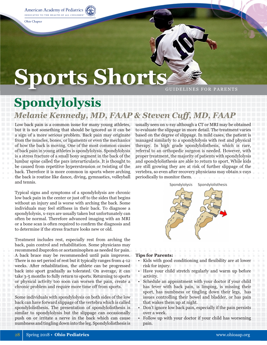 Spondylolysis