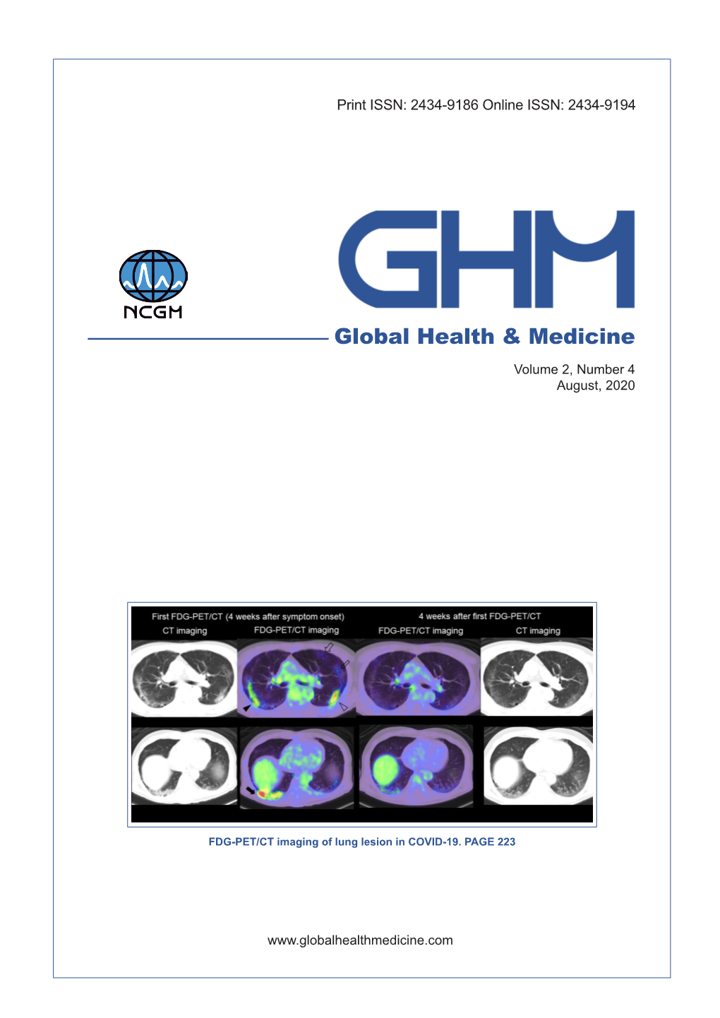 Pancreatic Islet Transplantation: Toward Definitive Treatment for Diabetes Mellitus