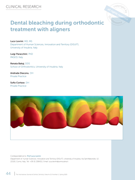 Dental Bleaching During Orthodontic Treatment with Aligners
