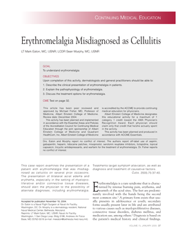 Erythromelalgia Misdiagnosed As Cellulitis
