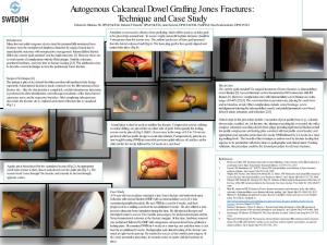 Autogenous Calcaneal Dowel Grafting Jones Fractures: Technique and Case Study Edward G