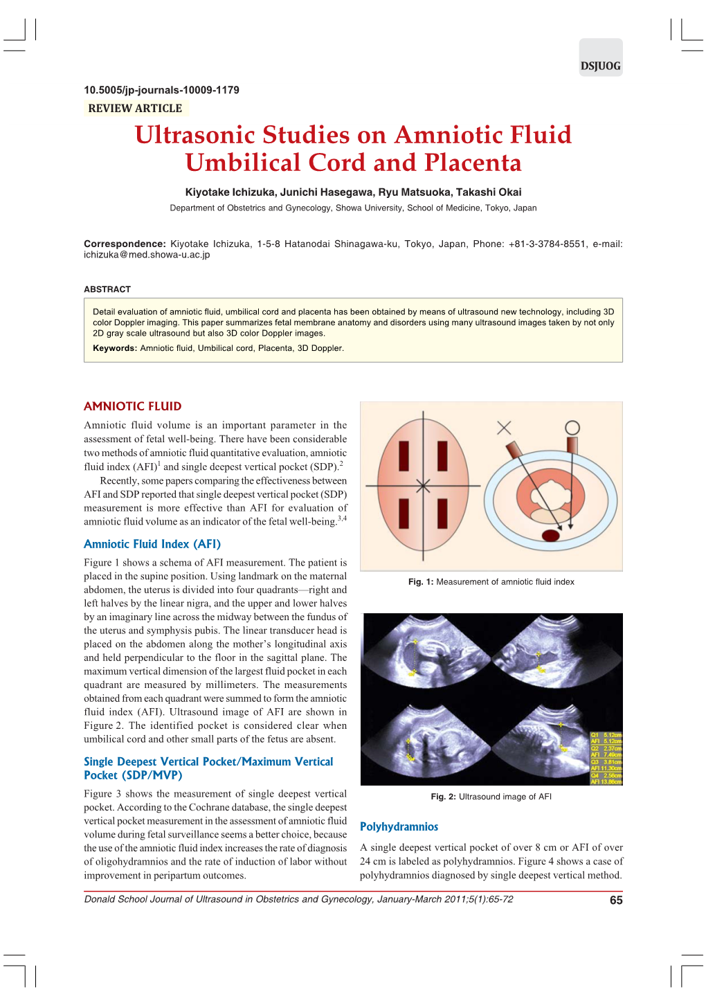 Ultrasonic Studies on Amniotic Fluid Umbilical Cord and Placenta