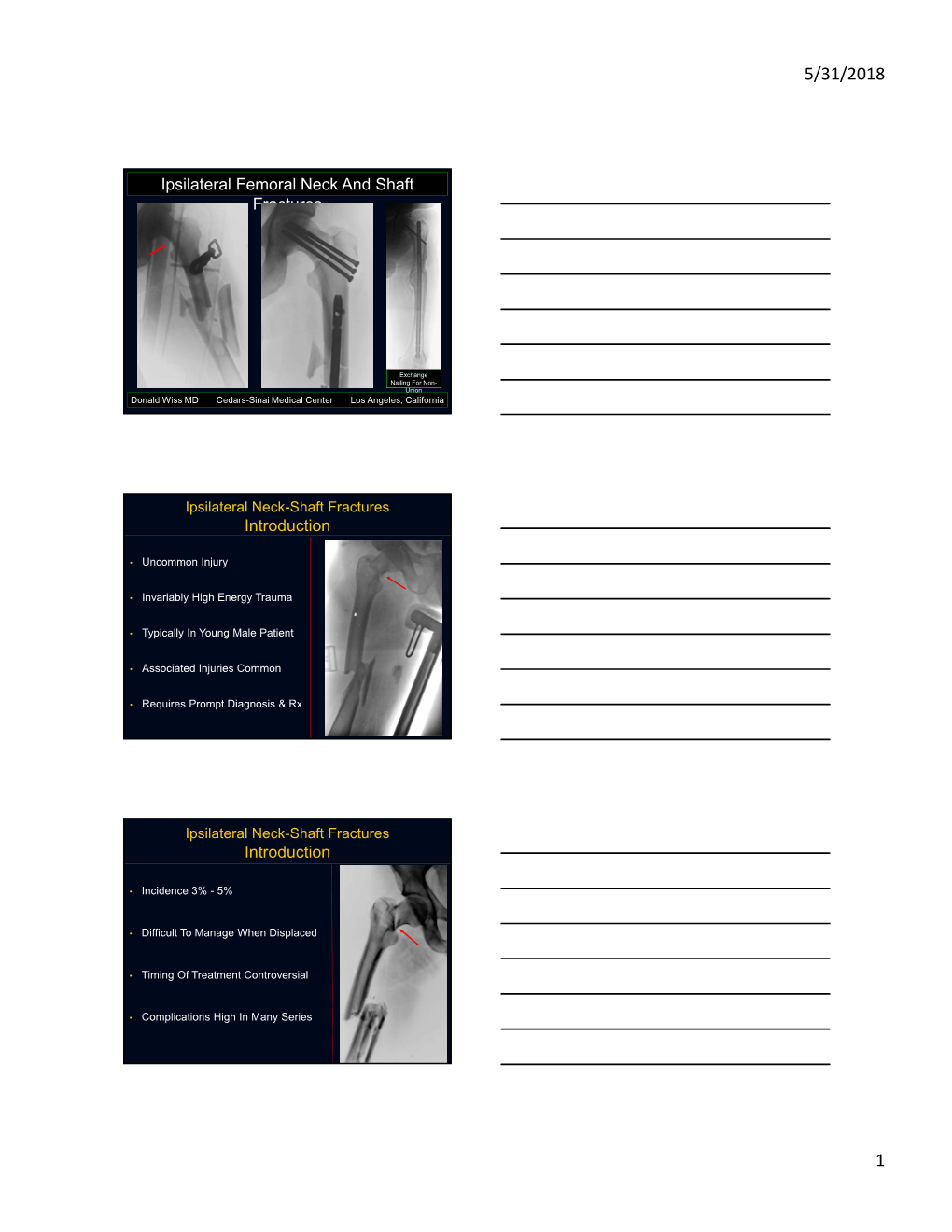 Ipsilateral Femoral Neck & Femoral Shaft Fracture