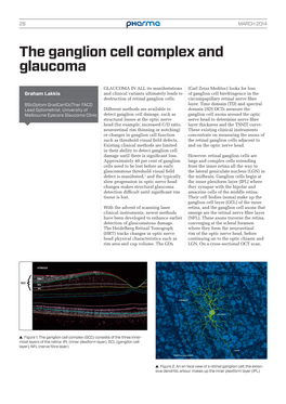 The Ganglion Cell Complex and Glaucoma