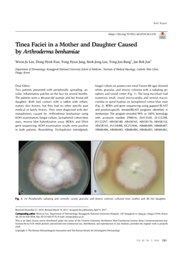 Tinea Faciei in a Mother and Daughter Caused by Arthroderma Benhamiae