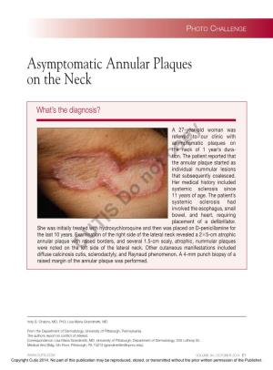 Asymptomatic Annular Plaques on the Neck