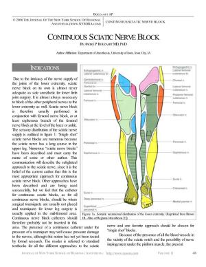 Continuous Sciatic Nerve Block Anesthesia (
