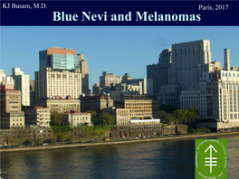 Blue Nevi and Melanomas Natural Blue BLUE NEVUS Blue Nevus (BN)
