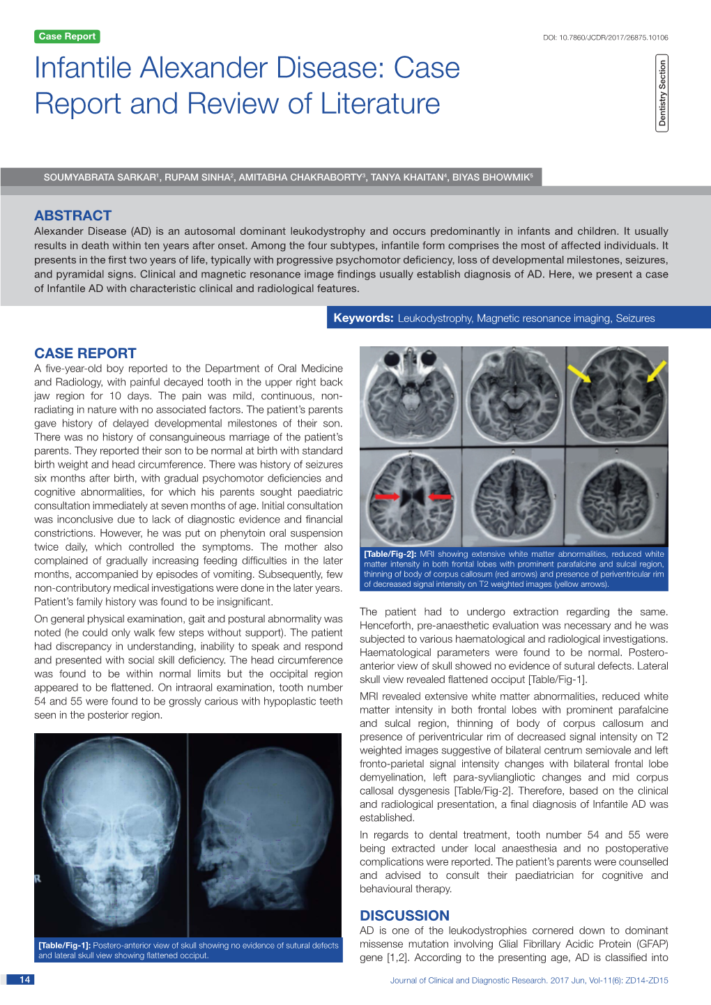 Infantile Alexander Disease: Case Report and Review of Literature Dentistry Section