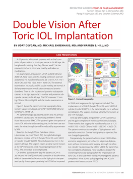 Double Vision After Toric IOL Implantation