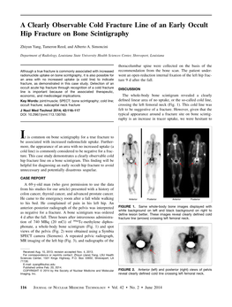 A Clearly Observable Cold Fracture Line of an Early Occult Hip Fracture on Bone Scintigraphy