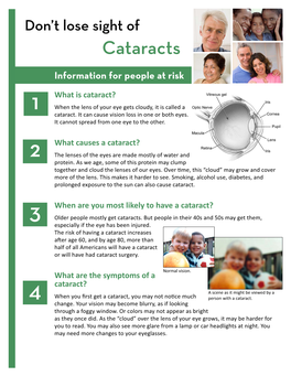 FAQ: Cataracts