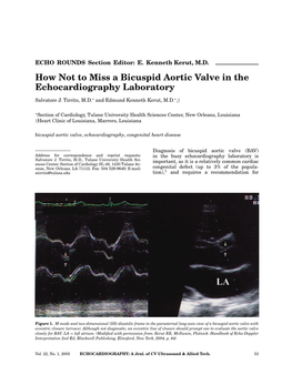 How Not to Miss a Bicuspid Aortic Valve in the Echocardiography Laboratory