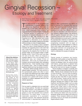 Gingival Recession – Etiology and Treatment