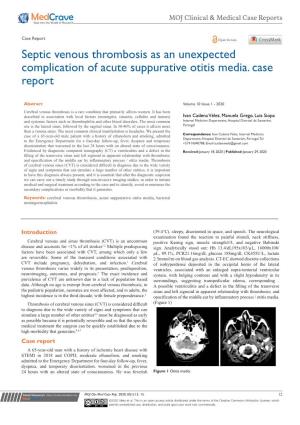 Septic Venous Thrombosis As an Unexpected Complication of Acute Suppurative Otitis Media