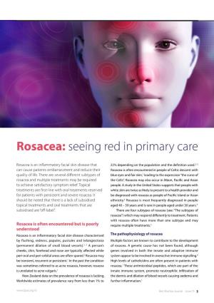 Rosacea: Seeing Red in Primary Care