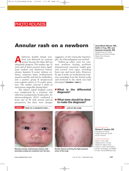 Annular Rash on a Newborn Keith A