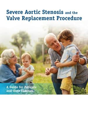 Severe Aortic Stenosis and the Valve Replacement Procedure