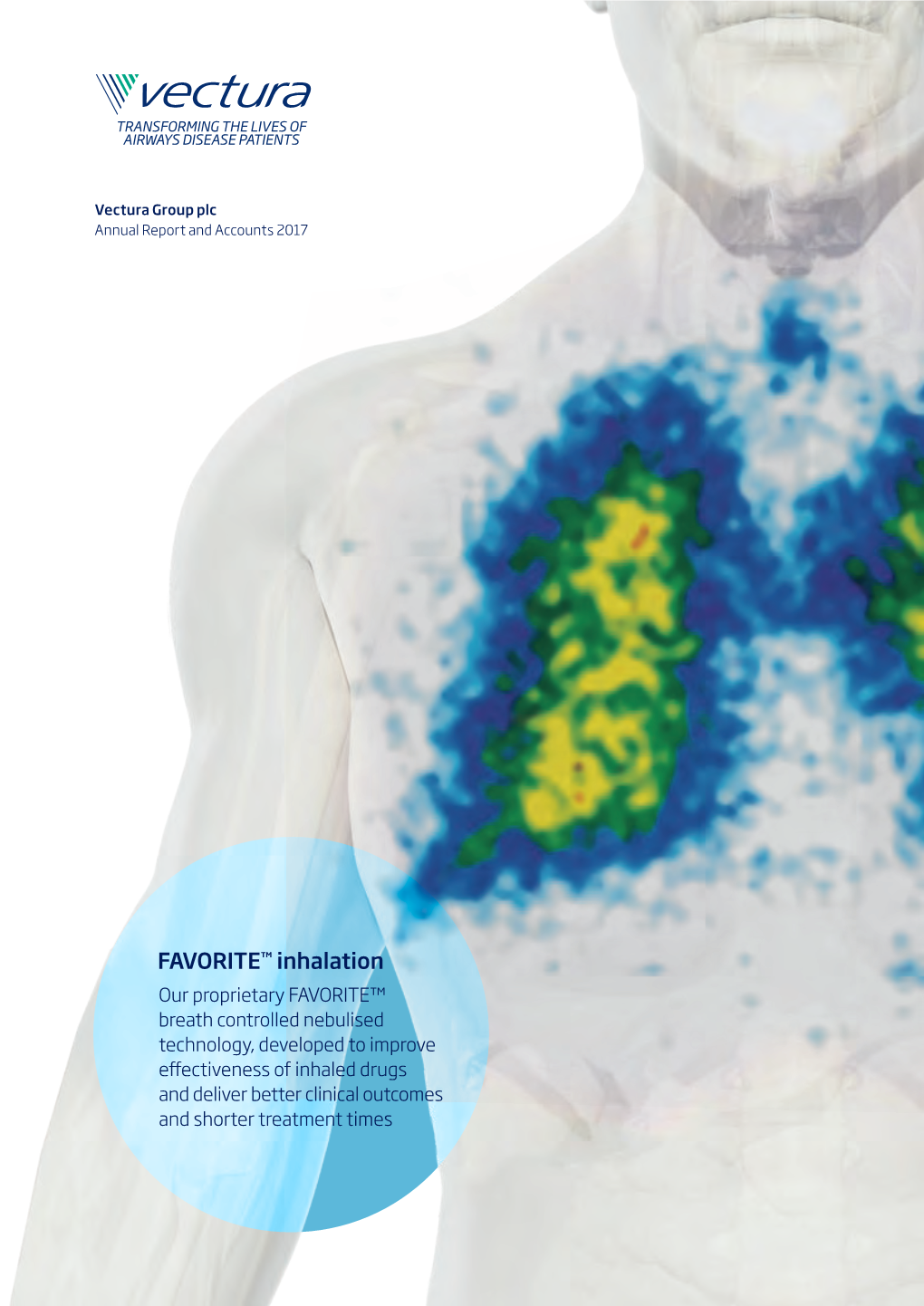 Vectura Group Plc Annual Report and Accounts 2017 Annual Report and Accounts 2017 Accounts and Report Annual