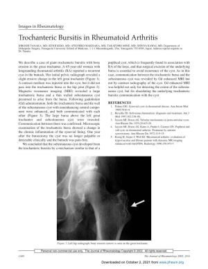 Trochanteric Bursitis in Rheumatoid Arthritis