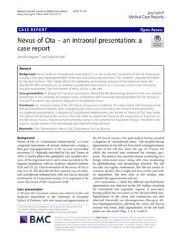 Nevus of Ota – an Intraoral Presentation: a Case Report Jennifer Maguire1* and Deborah Holt2