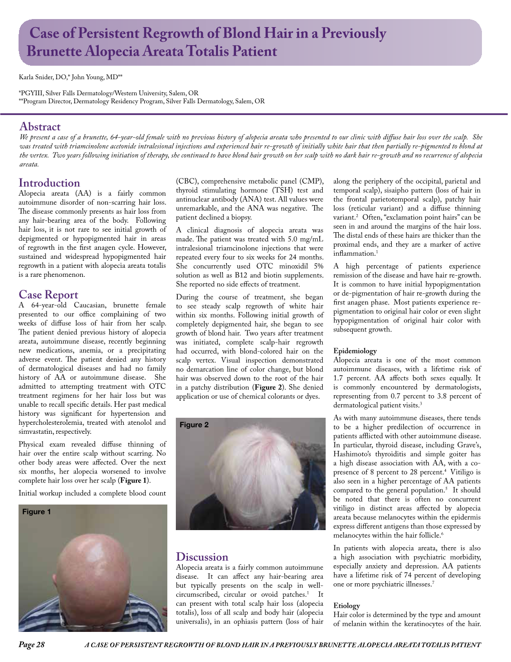Case of Persistent Regrowth of Blond Hair in a Previously Brunette Alopecia Areata Totalis Patient