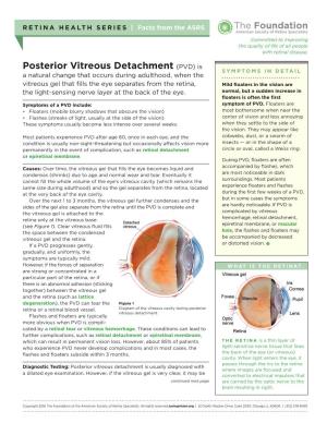 Posterior Vitreous Detachment (PVD) Is