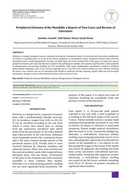 Peripheral Osteoma of the Mandible a Report of Two Cases and Review of Literature