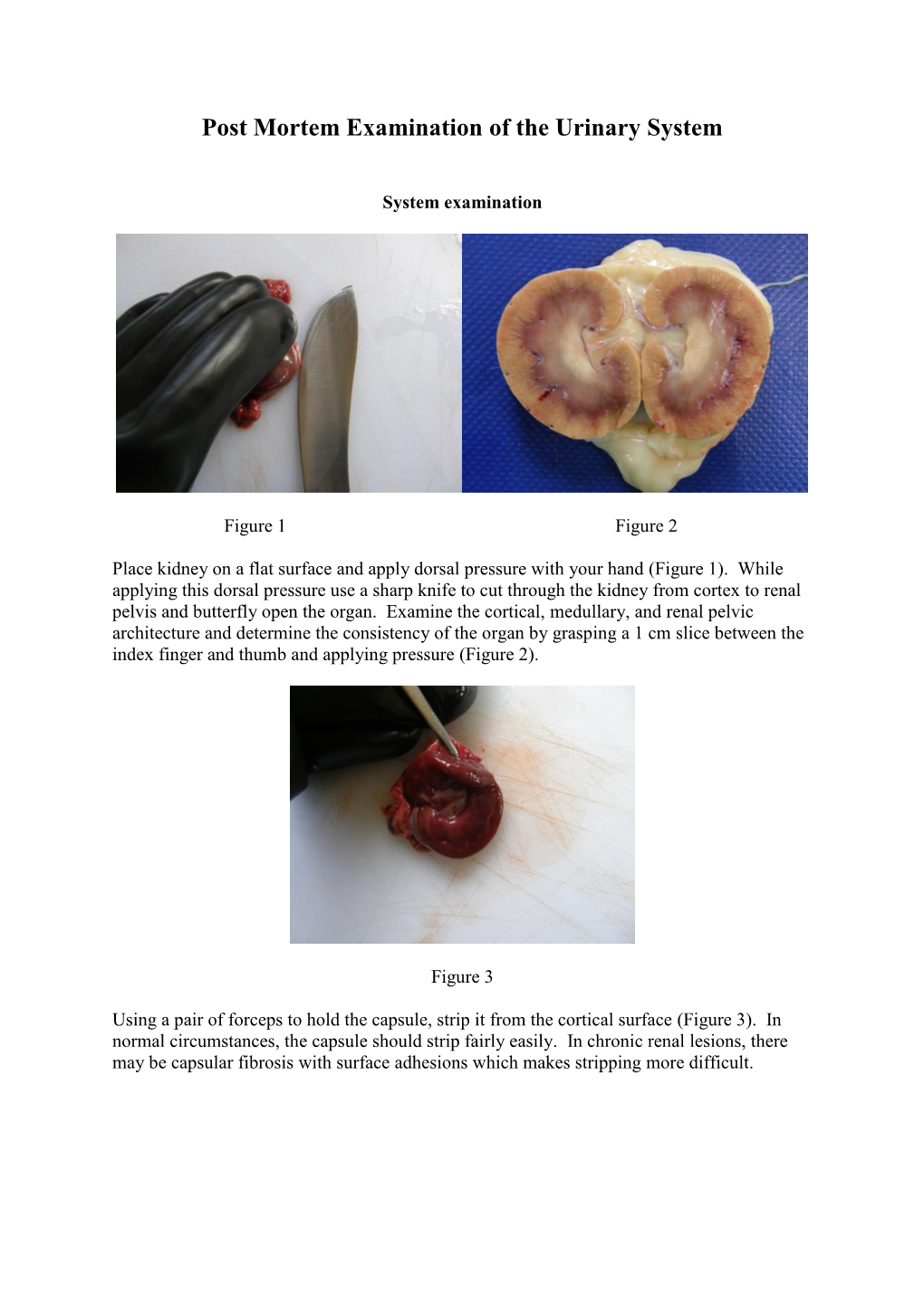 Post Mortem Examination of the Urinary System