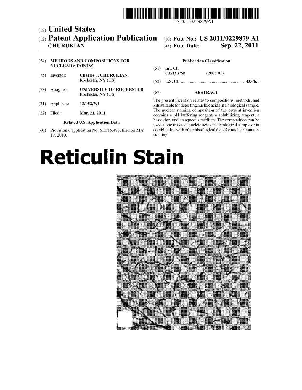 Reticulin Stain