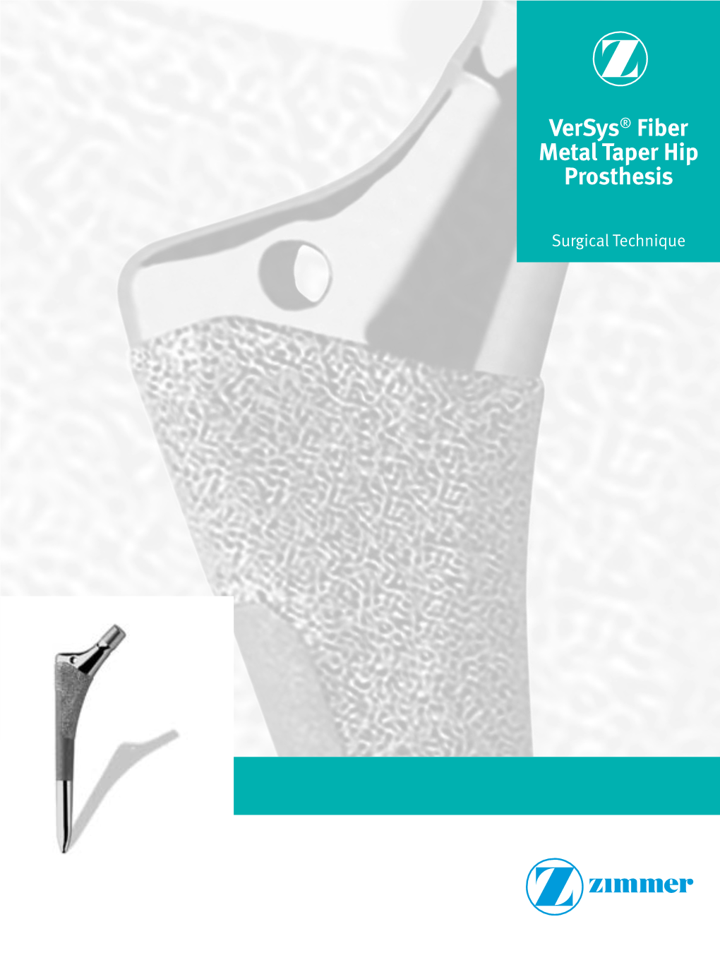 Versys® Fiber Metal Taper Hip Prosthesis Surgical Technique 1