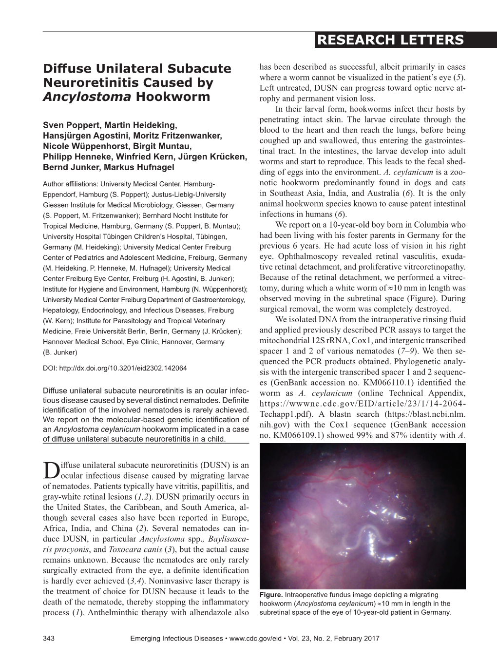 Diffuse Unilateral Subacute Neuroretinitis Caused by Ancylostoma Hookworm