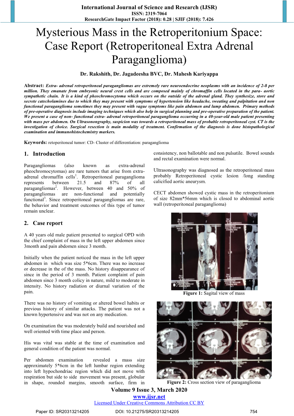 Retroperitoneal Extra Adrenal Paraganglioma)