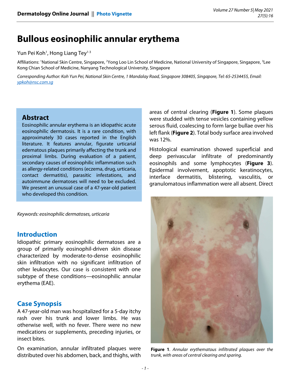 Bullous Eosinophilic Annular Erythema