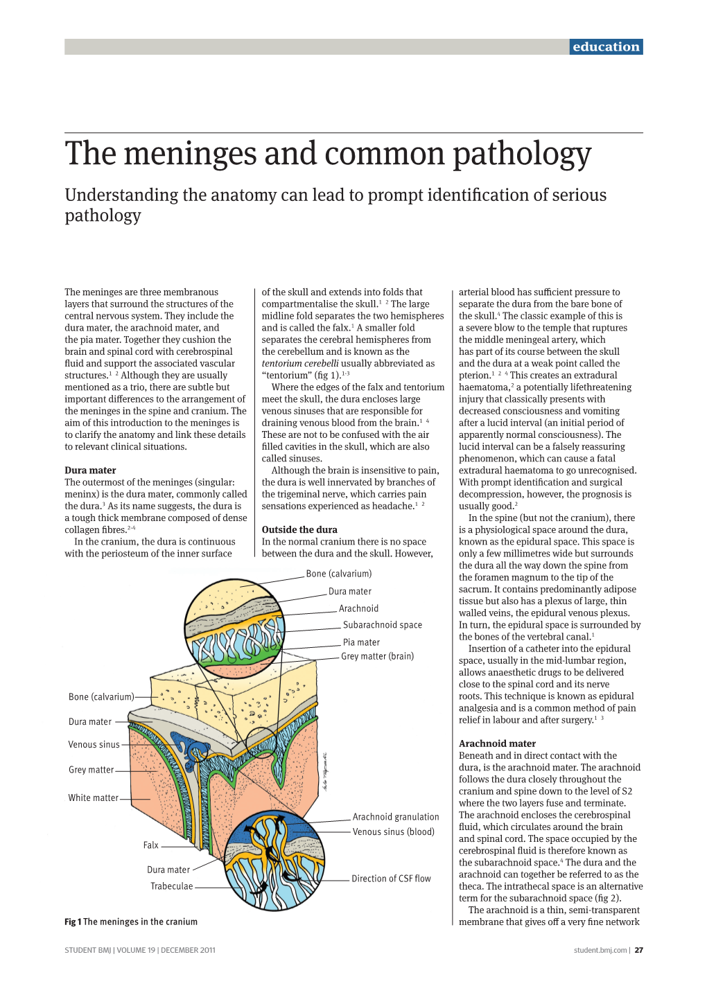 The Meninges and Common Pathology Understanding the Anatomy Can Lead to Prompt Identification of Serious Pathology