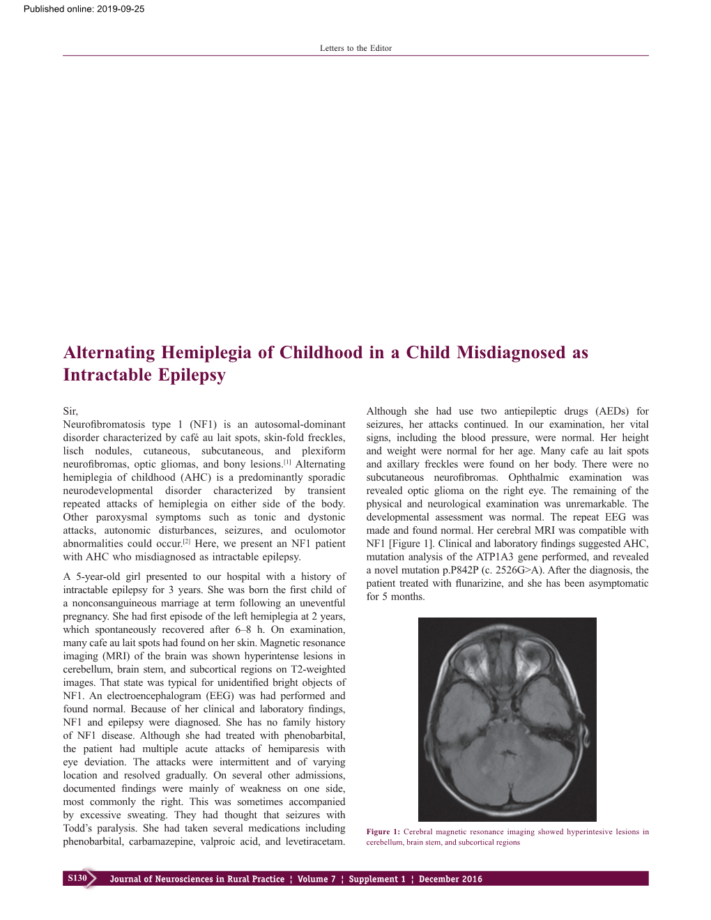 Alternating Hemiplegia of Childhood in a Child Misdiagnosed As Intractable Epilepsy