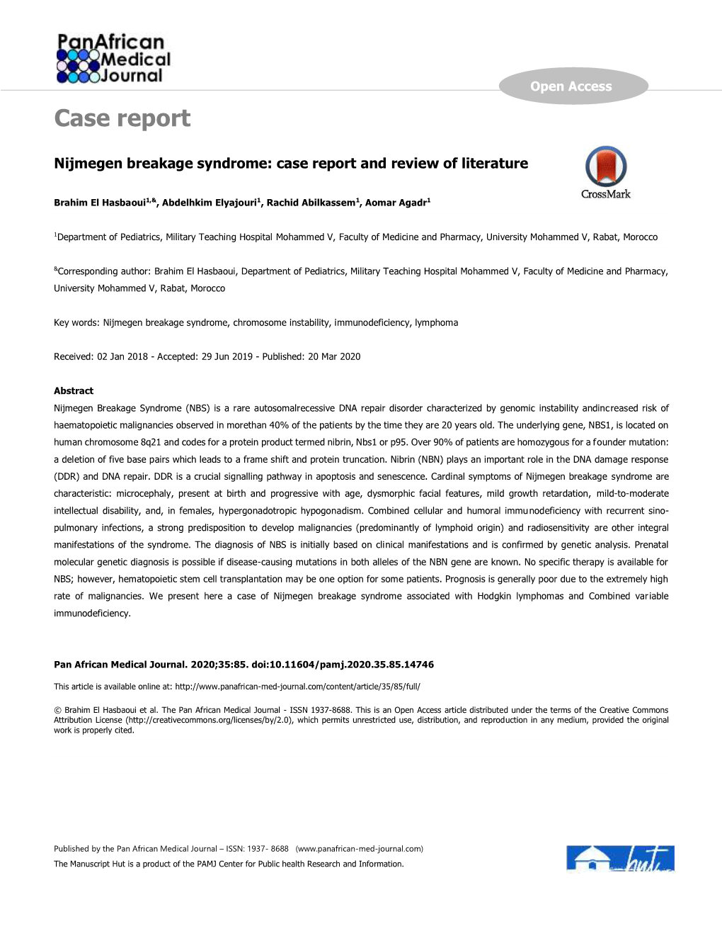 Nijmegen Breakage Syndrome: Case Report and Review of Literature