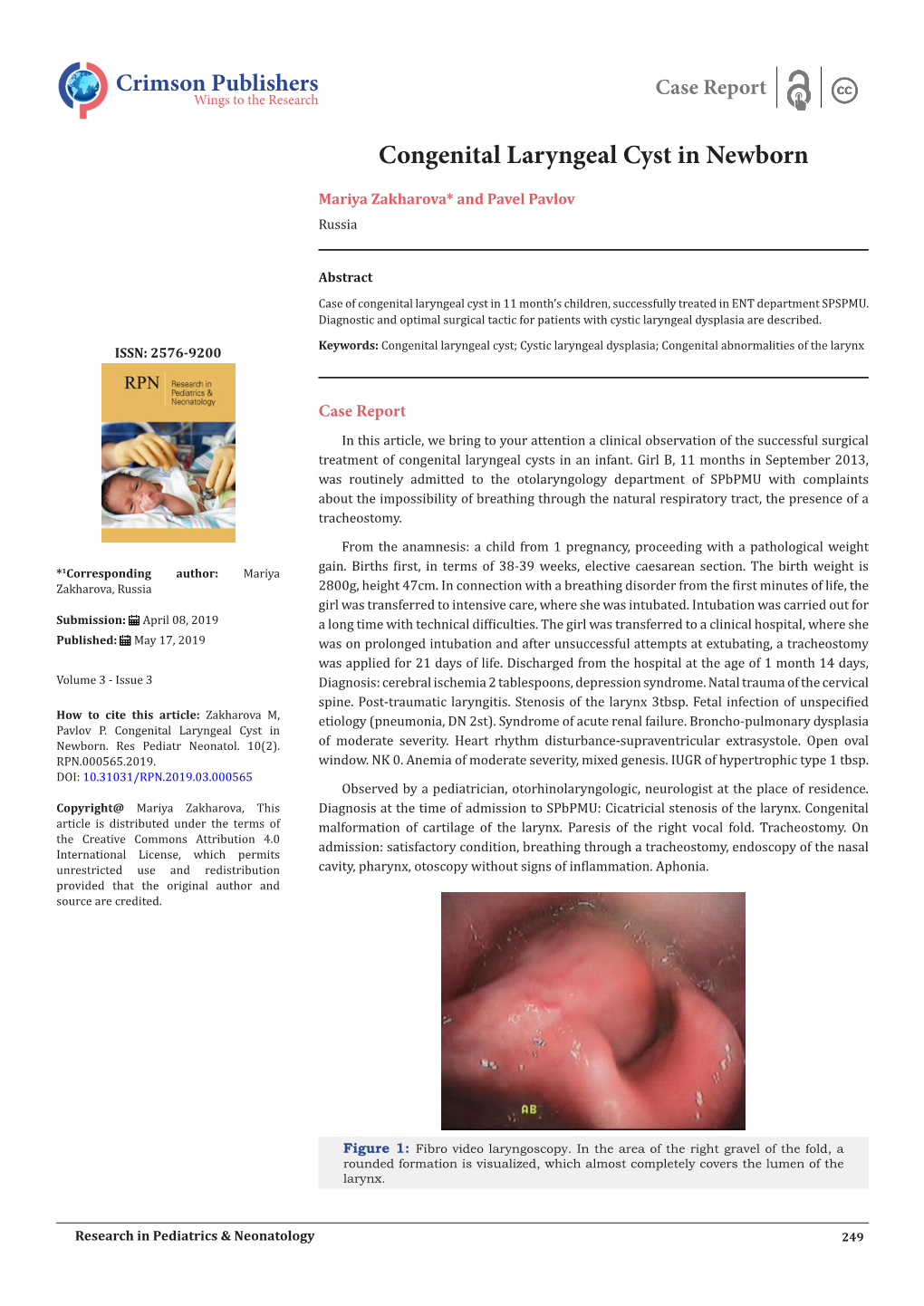 Congenital Laryngeal Cyst in Newborn