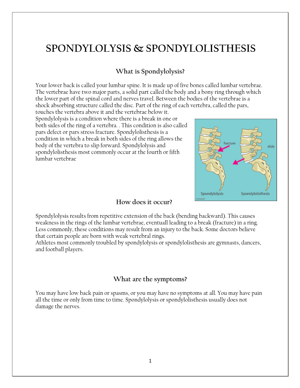 Spondylolysis & Spondylolisthesis