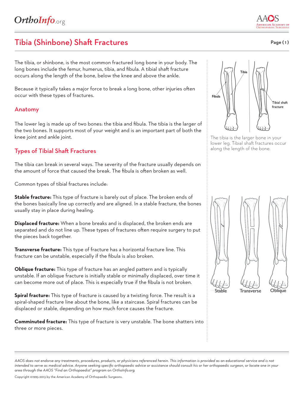 Org Tibia (Shinbone) Shaft Fractures